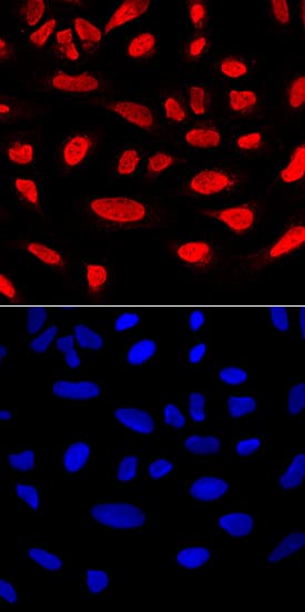 Immunocytochemistry RUNX2/CBFA1 Antibody (232902) [Unconjugated]