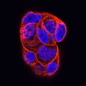 Rab13 was detected in immersion fixed Caco-2 human colorectal adenocarcinoma cell line using Mouse Anti-Human Rab13 Monoclonal Antibody (Catalog # MAB8305) at 25 µg/mL for 3 hours at room temperature. Cells were stained using the NorthernLights™ 557-conjugated Anti-Mouse IgG Secondary Antibody (red; NL007) and counterstained with DAPI (blue). Specific staining was localized to plasma membrane. View our protocol for Fluorescent ICC Staining of Cells on Coverslips.