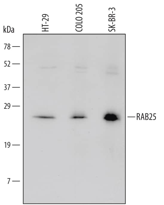Western blot shows lysates of HT-29 human colon adenocarcinoma cell line, COLO 205 human colorectal adenocarcinoma cell line, and SK-BR-3 human breast cancer cell line. PVDF Membrane was probed with 2 µg/mL of Human RAB25 Antigen Affinity-purified Polyclonal Antibody (Catalog # AF6605) followed by HRP-conjugated Anti-Goat IgG Secondary Antibody (Catalog # HAF109). A specific band was detected for RAB25 at approximately 25 kDa (as indicated). This experiment was conducted under reducing conditions and using Immunoblot Buffer Group 1.