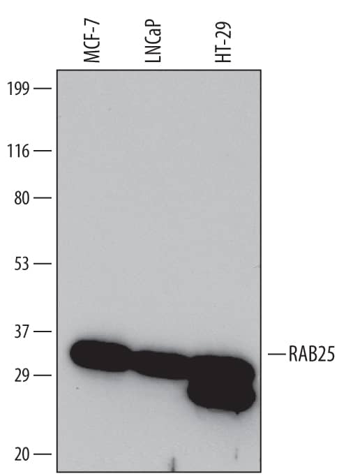 Western blot shows lysates of MCF-7 human breast cancer cell line, LNCaP human prostate cancer cell line, and HT-29 human colon adenocarcinoma cell line. PVDF Membrane was probed with 1 µg/mL of Mouse Anti-Human RAB25 Monoclonal Antibody (Catalog # MAB6605) followed by HRP-conjugated Anti-Mouse IgG Secondary Antibody (Catalog # HAF007). A specific band was detected for RAB25 at approximately 30 kDa (as indicated). This experiment was conducted under reducing conditions and using Immunoblot Buffer Group 1.