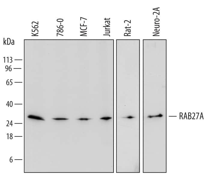 Western blot shows lysates of K562 human chronic myelogenous leukemia cell line, 786-O human renal cell adenocarcinoma cell line, MCF-7 human breast cancer cell line, Jurkat human acute T cell leukemia cell line, Rat-2 rat embryonic fibroblast cell line, and Neuro-2A mouse neuroblastoma cell line. PVDF membrane was probed with 0.5 µg/mL of Sheep Anti-Human/Mouse/Rat RAB27A Antigen Affinity-purified Polyclonal Antibody (Catalog # AF7245) followed by HRP-conjugated Anti-Sheep IgG Secondary Antibody (Catalog # HAF016). A specific band was detected for RAB27A at approximately 28 kDa (as indicated). This experiment was conducted under reducing conditions and using Immunoblot Buffer Group 1.