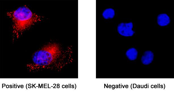 Rab27a was detected in immersion fixed SK-Mel-28 human malignant melanoma cell line (left panel; positive staining) and Daudi human Burkitt's lymphoma cell line (right panel; negative staining) using Rabbit Anti-Human Rab27a Monoclonal Antibody (Catalog # MAB7245) at 3 µg/mL for 3 hours at room temperature. Cells were stained using the NorthernLights™ 557-conjugated Anti-Rabbit IgG Secondary Antibody (red; NL004) and counterstained with DAPI (blue). Specific staining was localized to cytoplasm. View our protocol for Fluorescent ICC Staining of Cells on Coverslips.
