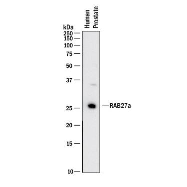 Western blot shows lysates of human prostate tissue. PVDF membrane was probed with 2 µg/mL of Rabbit Anti-Human Rab27a Monoclonal Antibody (Catalog # MAB7245) followed by HRP-conjugated Anti-Rabbit IgG Secondary Antibody (HAF008). A specific band was detected for Rab27a at approximately 26 kDa (as indicated). This experiment was conducted under reducing conditions and using Immunoblot Buffer Group 1.