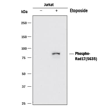 Western blot shows lysates of Jurkat human acute T cell leukemia cell line untreated (-) or treated (+) with 25 µM Etoposide for 6 hours. PVDF membrane was probed with 0.5 µg/mL of Rabbit Anti-Human Phospho-Rad17 (S635) Polyclonal Antibody (Catalog # MAB1374) followed by HRP-conjugated Anti-Rabbit IgG Secondary Antibody (Catalog # HAF008). A specific band was detected for Rad17 at approximately 75 kDa (as indicated). This experiment was conducted under reducing conditions and using Immunoblot Buffer Group 1.