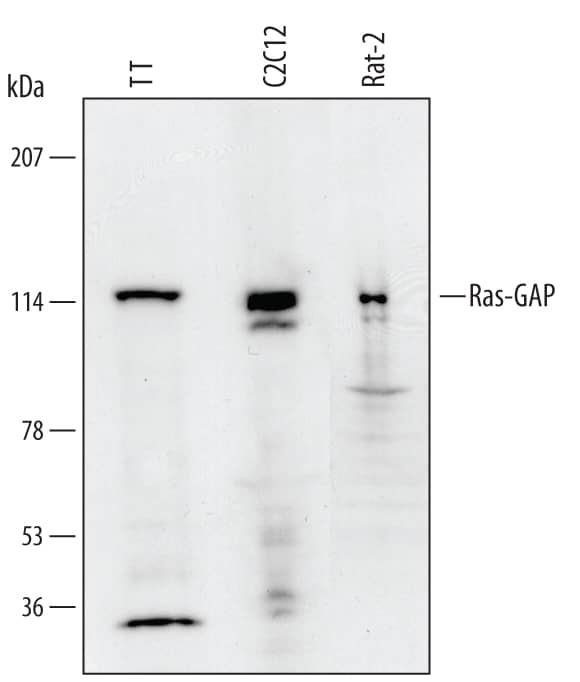 Western Blot Ras-GAP Antibody