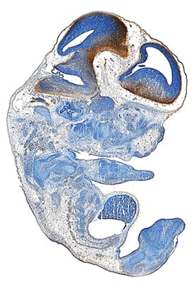 Immunohistochemistry Reelin Antibody [Unconjugated]