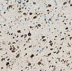 Reelin was detected in immersion fixed paraffin-embedded sections of human brain using Mouse Anti-Human Reelin Monoclonal Antibody (Catalog # MAB8546) at 5 µg/mL overnight at 4 °C. Tissue was stained using the Anti-Mouse HRP-DAB Cell & Tissue Staining Kit (brown; Catalog # CTS002) and counterstained with hematoxylin (blue). Specific staining was localized to neuronal cytoplasm. View our protocol for Chromogenic IHC Staining of Paraffin-embedded Tissue Sections.