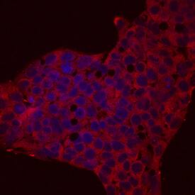 Reg3A was detected in immersion fixed HepG2 human hepatocellular carcinoma cell line using Mouse Anti-Human Reg3A Mono-clonal Antibody (Catalog # MAB5965) at 10 µg/mL for 3 hours at room temperature. Cells were stained using the Northern-Lights™ 557-conjugated Anti-Mouse IgG Secondary Antibody (red; Catalog # NL007) and counterstained with DAPI (blue). Specific staining was localized to cytoplasm. View our protocol for Fluorescent ICC Staining of Cells on Coverslips.
