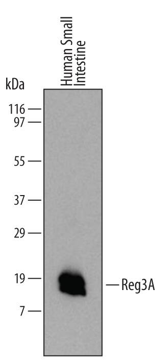 Western blot shows lysates of human small intestine tissue. PVDF membrane was probed with 2 µg/mL of Mouse Anti-Human Reg3A Monoclonal Antibody (Catalog # MAB5965) followed by HRP-conjugated Anti-Mouse IgG Secondary Antibody (Catalog # HAF007). A specific band was detected for Reg3A at approximately 17 kDa (as indicated). This experiment was conducted under reducing conditions and using Immunoblot Buffer Group 1.