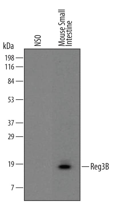 Western Blot Reg3B Antibody (518630)