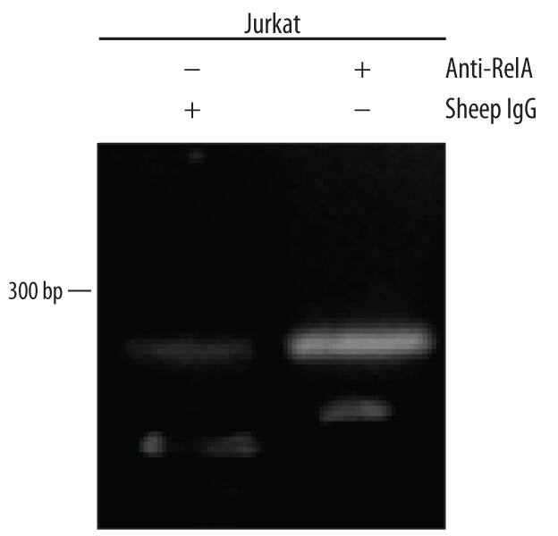 <b>Biological Strategies Validation. </b>Jurkat human acute T cell leukemia cell line treated with 50 ng/mL PMA and 200 ng/mL calcium ionomycin for overnight was fixed using formaldehyde, resuspended in lysis buffer, and sonicated to shear chromatin. RelA/NF kappa B p65/DNA complexes were immunoprecipitated using 5 µg Sheep Anti-Human/Mouse/Rat RelA/NF kappa B p65 Antigen Affinity-purified Polyclonal Antibody (Catalog # AF5078) or control antibody (Catalog # 5-001-A) for 15 minutes in an ultrasonic bath, followed by Biotinylated Anti-Sheep IgG Secondary Antibody (Catalog # [[catalogNumber:BAF016). Immunocomplexes were captured using 50 µL of MagCellect Streptavidin Ferrofluid (Catalog # [[catalogNumber:MAG999) and DNA was purified using chelating resin solution. Thep21promoter was detected by standard PCR.