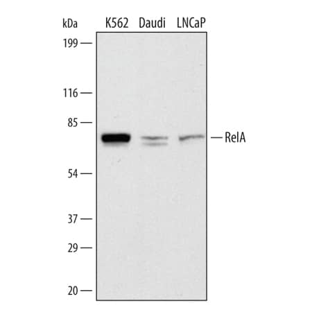 Western blot shows lysates of K562 human chronic myelogenous leukemia cell line, Daudi human Burkitt's lymphoma cell line, and LNCaP human prostate cancer cell line. PVDF membrane was probed with 1 µg/mL of Sheep Anti-Human/Mouse/Rat RelA/NF kappa B p65 Antigen Affinity-purified Polyclonal Antibody (Catalog # AF5078) followed by HRP-conjugated Anti-Sheep IgG Secondary Antibody (Catalog # HAF016). A specific band was detected for RelA/NF kappa B p65 at approximately 70 kDa (as indicated). This experiment was conducted under reducing conditions and using Immunoblot Buffer Group 1.