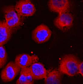 RelA/NF kappa B p65 was detected in immersion fixed K562 human chronic myelogenous leukemia cell line using Mouse Anti-Human/Mouse/Rat RelA/NF kappa B p65 Monoclonal Antibody (Catalog # MAB5078) at 10 µg/mL for 3 hours at room temperature. Cells were stained using the NorthernLights™ 557-conjugated Anti-Mouse IgG Secondary Antibody (red; Catalog # NL007) and counterstained with DAPI (blue). View our protocol for Fluorescent ICC Staining of Non-adherent Cells.