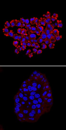 <b>Biological Strategies Validation. </b>RelA/NF kappa B p65 phosphorylated at S536 was detected in immersion fixed HT-29 human colon adenocarcinoma cell line untreated (lower panel) or treated with Calyculin A (Catalog # 1336) and Recombinant Human TNF-a (Catalog # 210-TA; upper panel) using Rabbit Anti-Human Phospho-RelA/NF kappa B p65 (S536) Monoclonal Antibody (Catalog # MAB72261) at 10 µg/mL for 3 hours at room temperature. Cells were stained using the NorthernLights™ 557-conjugated Anti-Rabbit IgG Secondary Antibody (red; Catalog # NL004) and counterstained with DAPI (blue). Specific staining was localized to cytoplasm and cell surfaces. View our protocol for Fluorescent ICC Staining of Cells on Coverslips.