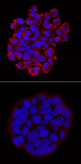 <b>Biological Strategies Validation. </b>RelA/NF kappa B p65 phosphorylated at S536 was detected in immersion fixed HT-29 human colon adenocarcinoma cell line untreated (lower panel) or treated with Calyculin A (Catalog # 1336) and Recombinant Human TNF-a (Catalog # 210-TA; upper panel) using Mouse Anti-Human Phospho-RelA/NF kappa B p65 (S536) Monoclonal Antibody (Catalog # MAB7226) at 2 µg/mL for 3 hours at room temperature. Cells were stained using the NorthernLights™ 557-conjugated Anti-Mouse IgG Secondary Antibody (red; Catalog # NL007) and counterstained with DAPI (blue). Specific staining was localized to cytoplasm and cell surfaces. View our protocol for Fluorescent ICC Staining of Cells on Coverslips.