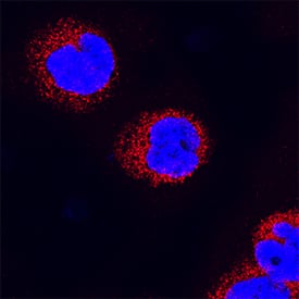 Immunocytochemistry RelB Antibody (315206) [Unconjugated]