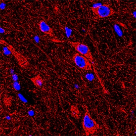Immunohistochemistry Relaxin R1/LGR7 Antibody (933344) [Unconjugated]