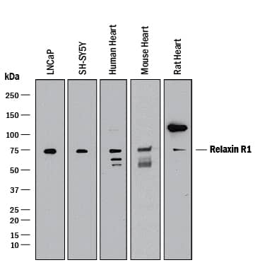 Western Blot Relaxin R1/LGR7 Antibody (933344) [Unconjugated]