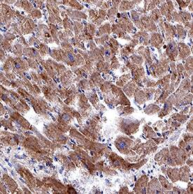 Immunohistochemistry Relaxin R2/LGR8 Antibody (1013901) [Unconjugated]