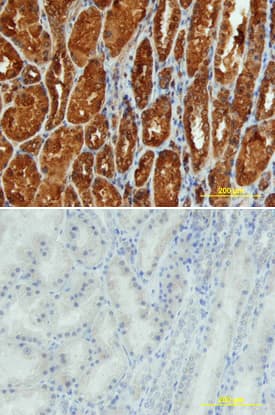 Renin was detected in immersion fixed paraffin-embedded sections of human kidney array using Sheep Anti-Human Renin Antigen Affinity-purified Polyclonal Antibody (Catalog # AF4090) at 10 µg/mL overnight at 4 °C. Tissue was stained using the Anti-Sheep HRP-DAB Cell & Tissue Staining Kit (brown; Catalog # CTS019) and counterstained with hematoxylin (blue). Lower panel shows a lack of labeling if primary antibodies are omitted and tissue is stained only with secondary antibody followed by incubation with detection reagents. View our protocol for Chromogenic IHC Staining of Paraffin-embedded Tissue Sections.