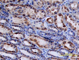 Renin was detected in immersion fixed paraffin-embedded sections of human kidney using Sheep Anti-Human Renin Antigen Affinity-purified Polyclonal Antibody (Catalog # AF4090) at 10 µg/mL overnight at 4 °C. Tissue was stained using the Anti-Sheep HRP-DAB Cell & Tissue Staining Kit (brown; Catalog # CTS019) and counterstained with hematoxylin (blue). View our protocol for Chromogenic IHC Staining of Paraffin-embedded Tissue Sections.