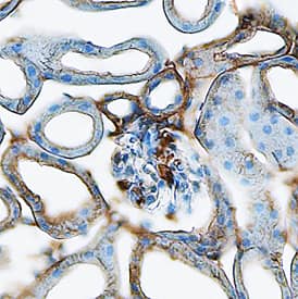 Immunohistochemistry Renin Antibody [Unconjugated] - 1