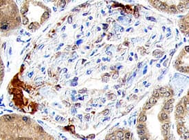 Renin was detected in immersion fixed paraffin-embedded sections of human kidney using 15 &micro;g/mL Mouse Anti-Human Renin Propeptide Monoclonal Antibody (Catalog # MAB4447) overnight at 4 &deg;C. Before incubation with the primary antibody tissue was subjected to heat-induced epitope retrieval using Antigen Retrieval Reagent-Basic (Catalog # CTS013). Tissue was stained with the Anti-Mouse HRP-DAB Cell & Tissue Staining Kit (brown; Catalog # CTS002) and counterstained with hematoxylin (blue). View our protocol for Chromogenic IHC Staining of Paraffin-embedded Tissue Sections.