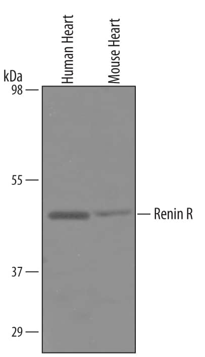 Western blot shows lysates of human and mouse heart tissue. PVDF membrane was probed with 1 µg/mL of Goat Anti-Human Renin R Antigen Affinity-purified Polyclonal Antibody (Catalog # AF5716) followed by HRP-conjugated Anti-Goat IgG Secondary Antibody (Catalog # HAF019). A specific band was detected for Renin R at approximately 45 kDa (as indicated). This experiment was conducted under reducing conditions and using Immunoblot Buffer Group 1.