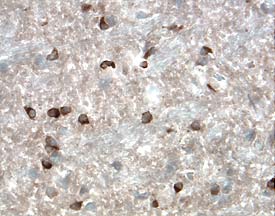 Resistin was detected in perfusion fixed frozen sections of mouse brain (caudate putamen) using 15 &micro;g/mL Mouse Resistin Antigen Affinity-purified Polyclonal Antibody (Catalog # AF1069) overnight at 4 &deg;C. Tissue was stained with the Anti-Goat HRP-DAB Cell & Tissue Staining Kit (brown; Catalog # CTS008) and counterstained with hematoxylin (blue). View our protocol for Chromogenic IHC Staining of Frozen Tissue Sections.