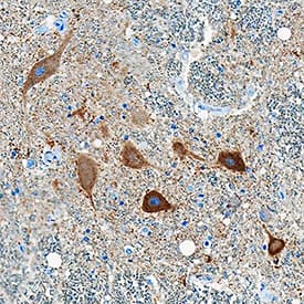 Immunohistochemistry Ret Antibody [Unconjugated]