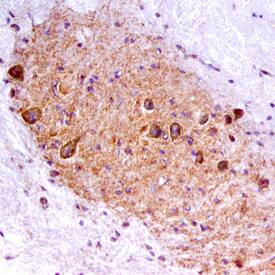 Ret was detected in perfusion fixed frozen sections of mouse spinal cord using Goat Anti-Mouse Ret Antigen Affinity-purified Polyclonal Antibody (Catalog # AF482) at 15 µg/mL overnight at 4 °C. Tissue was stained using the Anti-Goat HRP-DAB Cell & Tissue Staining Kit (brown; Catalog # CTS008) and counterstained with hematoxylin (blue). Specific staining was localized to the ventral horn. View our protocol for Chromogenic IHC Staining of Frozen Tissue Sections.