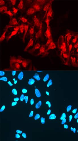 Immunocytochemistry Rex-1/ZFP42 Antibody