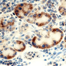 Immunohistochemistry Ribosomal Protein L17 Antibody (702142)