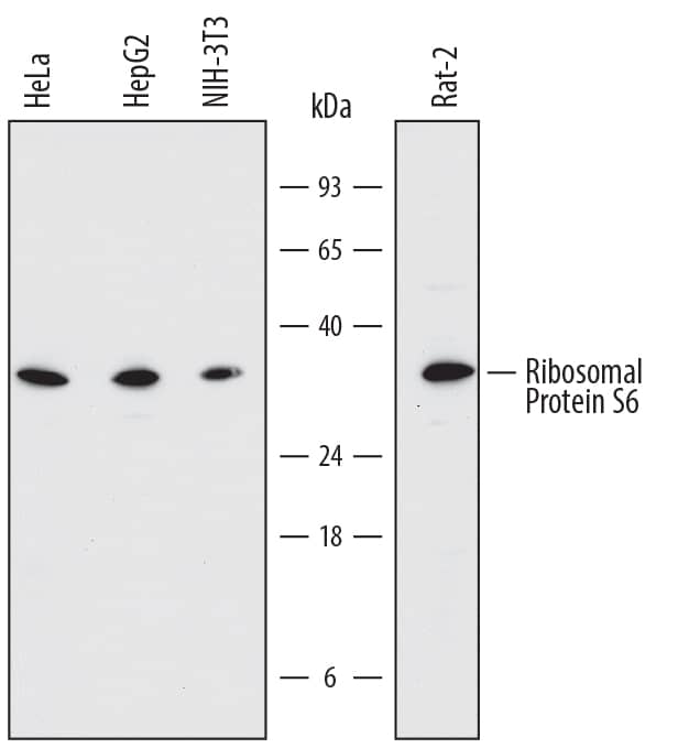 Western blot shows lysates of HeLa human cervical epithelial carcinoma cell line, HepG2 human hepatocellular carcinoma cell line, NIH-3T3 mouse embryonic fibroblast cell line, and Rat-2 rat embryonic fibroblast cell line. PVDF membrane was probed with 1 µg/mL of Sheep Anti-Human/Mouse/Rat Ribosomal Protein S6 Antigen Affinity-purified Polyclonal Antibody (Catalog # AF5436) followed by HRP-conjugated Anti-Sheep IgG Secondary Antibody (Catalog # HAF016). A specific band was detected for Ribosomal Protein S6 at approximately 32 kDa (as indicated). This experiment was conducted under reducing conditions and using Immunoblot Buffer Group 1.