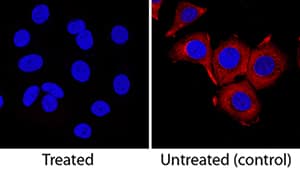 <b>Biological Strategies Validation. </b>Ribosomal Protein S6/RPS6 was detected in immersion fixed MCF-7 human breast cancer cell line untreated or treated with Rapamycin using Rat Anti-Human Phospho-Ribosomal Protein S6/RPS6 (S235/S236) Monoclonal Antibody (Catalog # MAB54361) at 3 µg/mL for 3 hours at room temperature. Cells were stained using the NorthernLights™ 557-conjugated Anti-Rat IgG Secondary Antibody (red; Catalog # NL013) and counterstained with DAPI (blue). Specific staining was localized to cytoplasm. View our protocol for Fluorescent ICC Staining of Cells on Coverslips.