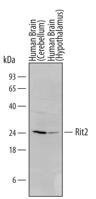 Western blot shows lysates of human brain (cerebellum) tissue and human brain (hypothalamus) tissue. PVDF Membrane was probed with 2 µg/mL of Mouse Anti-Human Rit2 Monoclonal Antibody (Catalog # MAB6094) followed by HRP-conjugated Anti-Mouse IgG Secondary Antibody (Catalog # HAF007). A specific band was detected for Rit2 at approximately 25 kDa (as indicated). This experiment was conducted under reducing conditions and using Immunoblot Buffer Group 1.