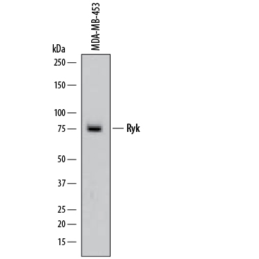 Western Blot Ryk Antibody (484804)