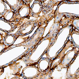 S100A10 was detected in perfusion fixed frozen sections of mouse kidney using Goat Anti-Mouse S100A10 Antigen Affinity-purified Polyclonal Antibody (Catalog # AF2377) at 15 µg/mL overnight at 4 °C. Tissue was stained using the Anti-Goat HRP-DAB Cell & Tissue Staining Kit (brown; Catalog # CTS008) and counterstained with hematoxylin (blue). Specific staining was localized to plasma membrane in epithelial cells. View our protocol for Chromogenic IHC Staining of Frozen Tissue Sections.