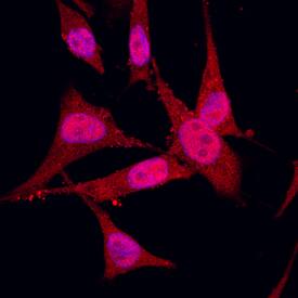 Immunocytochemistry S100A2 Antibody [Unconjugated]