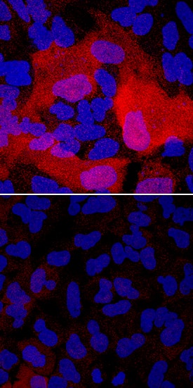 S100A4 was detected in immersion fixed A549 human lung carcinoma cells unstimulated (lower panel) and stimulated with the EMT Inducing Media Supplement (upper panel; Catalog # CCM017) using Mouse Anti-Human S100A4 Monoclonal Antibody (Catalog # MAB4137) at 1 µg/mL for 3 hours at room temperature. Cells were stained using the NorthernLights™ 557-conjugated Anti-Mouse IgG Secondary Antibody (red; Catalog # NL007) and counterstained with DAPI (blue). Specific staining was localized to cytoplasm. View our protocol for Fluorescent ICC Staining of Cells on Coverslips.