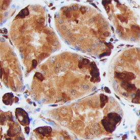 S100A6 was detected in immersion fixed paraffin-embedded sections of human kidney using Sheep Anti-Human/Mouse S100A6 Antigen Affinity-purified Polyclonal Antibody (Catalog # AF4584) at 3 µg/mL overnight at 4 °C. Before incubation with the primary antibody, tissue was subjected to heat-induced epitope retrieval using Antigen Retrieval Reagent-Basic (CTS013). Tissue was stained using the Anti-Sheep HRP-DAB Cell & Tissue Staining Kit (brown; Catalog # CTS019) and counterstained with hematoxylin (blue). Specific staining was localized to epithelial cells in convoluted tubules. View our protocol for Chromogenic IHC Staining of Paraffin-embedded Tissue Sections.