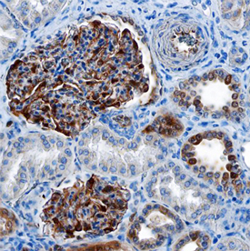 S100A6 was detected in immersion fixed paraffin-embedded sections of human kidney using Mouse Anti-Human S100A6 Monoclonal Antibody (Catalog # MAB7467) at 15 µg/mL overnight at 4 °C. Before incubation with the primary antibody, tissue was subjected to heat-induced epitope retrieval using Antigen Retrieval Reagent-Basic (Catalog # CTS013). Tissue was stained using the Anti-Mouse HRP-DAB Cell & Tissue Staining Kit (brown; Catalog # CTS002) and counter-stained with hematoxylin (blue). Specific staining was localized to glomeruli and distal tubules. View our protocol for Chromogenic IHC Staining of Paraffin-embedded Tissue Sections.