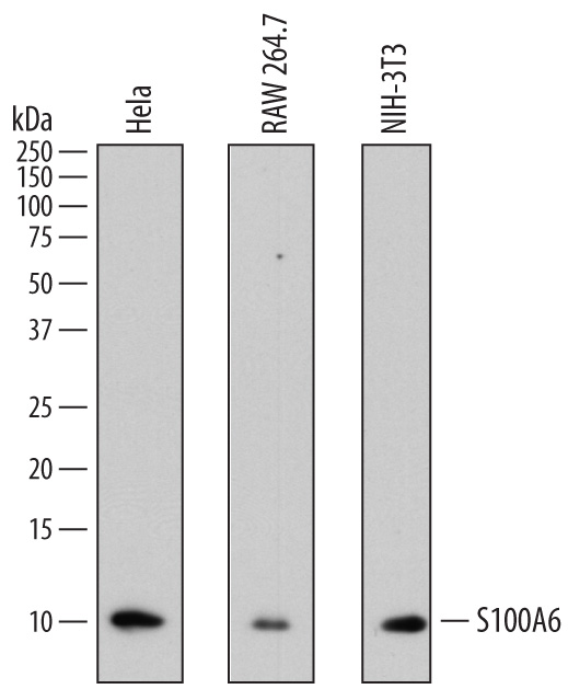 Western blot shows lysates of HeLa human cervical epithelial carcinoma cell line, RAW 264.7 mouse monocyte/macrophage cell line, and NIH-3T3 mouse embryonic fibroblast cell line. PVDF membrane was probed with 2 µg/mL of Mouse Anti-Human S100A6 Monoclonal Antibody (Catalog # MAB7467) followed by HRP-conjugated Anti-Mouse IgG Secondary Antibody (Catalog # HAF007). A specific band was detected for S100A6 at approximately 10 kDa (as indicated). This experiment was conducted under reducing conditions and using Immunoblot Buffer Group 1.