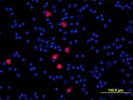 S100A8 was detected in immersion fixed mouse splenocytes using Goat Anti-Mouse S100A8 Antigen Affinity-purified Polyclonal Antibody (Catalog # AF3059) at 10 µg/mL for 3 hours at room temperature. Cells were stained using the NorthernLights™ 557-conjugated Anti-Goat IgG Secondary Antibody (red; Catalog # NL001) and counter-stained with DAPI (blue). View our protocol for Fluorescent ICC Staining of Non-adherent Cells.