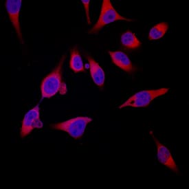 S100A8 was detected in immersion fixed HeLa human cervical epithelial carcinoma cell line using Sheep Anti-Human S100A8 Antigen Affinity-purified Polyclonal Antibody (Catalog # AF4570) at 10 µg/mL for 3 hours at room temperature. Cells were stained using the NorthernLights™ 557-conjugated Anti-Sheep IgG Secondary Antibody (red; Catalog # NL010) and counterstained with DAPI (blue). Specific staining was localized to cytoplasm. View our protocol for Fluorescent ICC Staining of Cells on Coverslips.