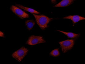 S100A8 was detected in immersion fixed NIH-3T3 mouse embryonic fibroblast cell line using 10 &micro;g/mL Rat Anti-Mouse S100A8 Monoclonal Antibody (Catalog # MAB3059) for 3 hours at room temperature. Cells were stained (red) and counterstained with DAPI (blue). View our protocol for Fluorescent ICC Staining of Cells on Coverslips.