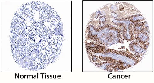 Immunohistochemistry S100A8/S100A9 Heterodimer Antibody (1099F) [Unconjugated]