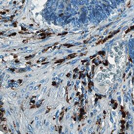 Immunohistochemistry S100A8/S100A9 Heterodimer Antibody (900027) [Unconjugated]
