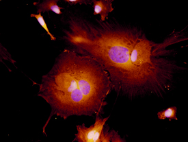 S100A9 was detected in immersion fixed XB2 mouse teratoma keratinocyte cell line using 10 µg/mL Goat Anti-Mouse S100A9 Antigen Affinity-purified Polyclonal Antibody (Catalog # AF2065) for 3 hours at room temperature. Cells were stained with the NorthernLights™ 557-conjugated Anti-Goat IgG Secondary Antibody (red; NL001) and counte-rstained with DAPI (blue). View our protocol for Fluorescent ICC Staining of Cells on Coverslips.