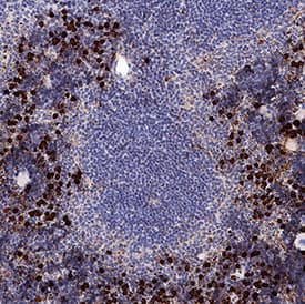S100A9 was detected in perfusion fixed frozen sections of mouse spleen using Goat Anti-Mouse S100A9 Antigen Affinity-purified Polyclonal Antibody (Catalog # AF2065) at 0.3 µg/mL for 1 hour at room temperature followed by incubation with the Anti-Goat IgG VisUCyte™ HRP Polymer Antibody (VC004). Tissue was stained using DAB (brown) and counterstained with hematoxylin (blue). Specific staining was localized to cytoplasm in splenocytes. View our protocol for IHC Staining with VisUCyte HRP Polymer Detection Reagents.